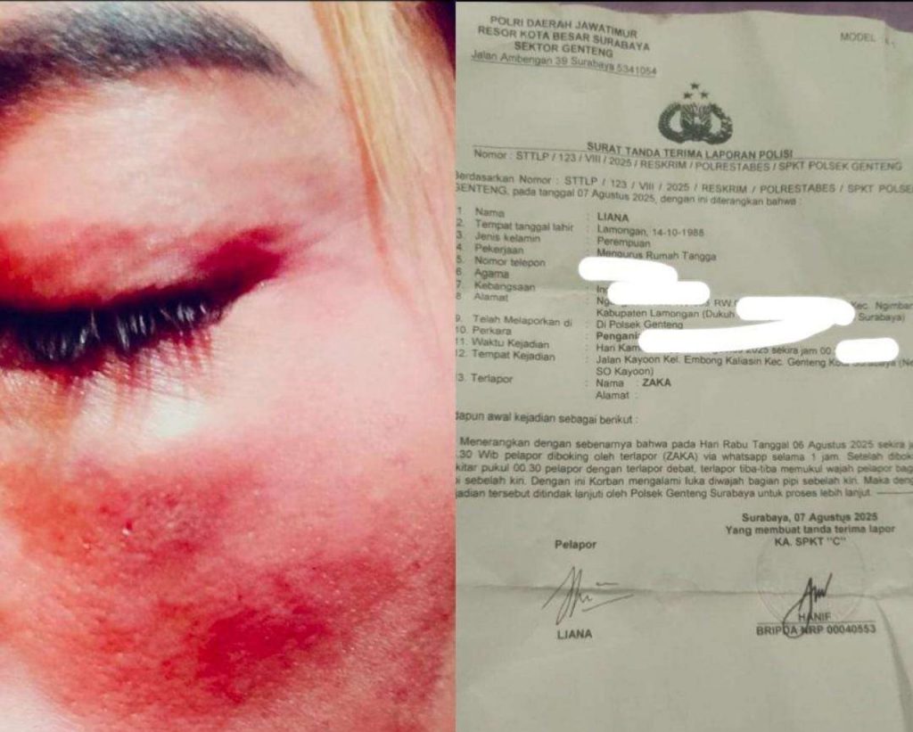 Kasus Penganiayaan di SO Kayoon Surabaya: Liana Minta Polisi Tetapkan Saka Jadi Tersangka