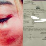 Kasus Penganiayaan di SO Kayoon Surabaya: Liana Minta Polisi Tetapkan Saka Jadi Tersangka