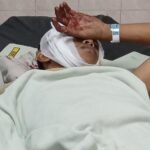 Warga Deketagung Kecamatan Sugio Kabupaten Lamongan Alami Luka Bacok Dikeroyok Sekelompok OTK