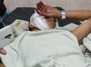 Warga Deketagung Kecamatan Sugio Kabupaten Lamongan Alami Luka Bacok Dikeroyok Sekelompok OTK