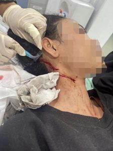 Gagal Rampas Tas, Pria di Tanah Abang Bacok Korban Luka 20 Jahitan