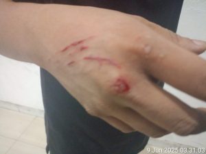 Wartawan Jadi Korban Pemukulan Orang Tak Dikenal di Cafe Bmart Kemayoran Jakarta Pusat