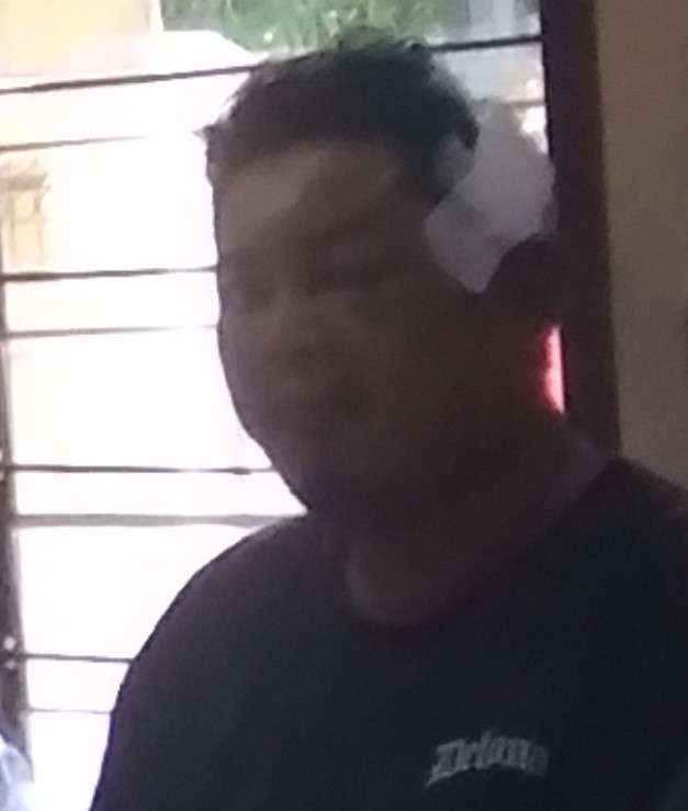 Foto: Korban dugaan pengeroyokan di Tanggulangin Sidoarjo mengalami luka berat di kepala saat kasus masih dalam proses penyidikan kepolisian.